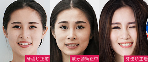 案例图片